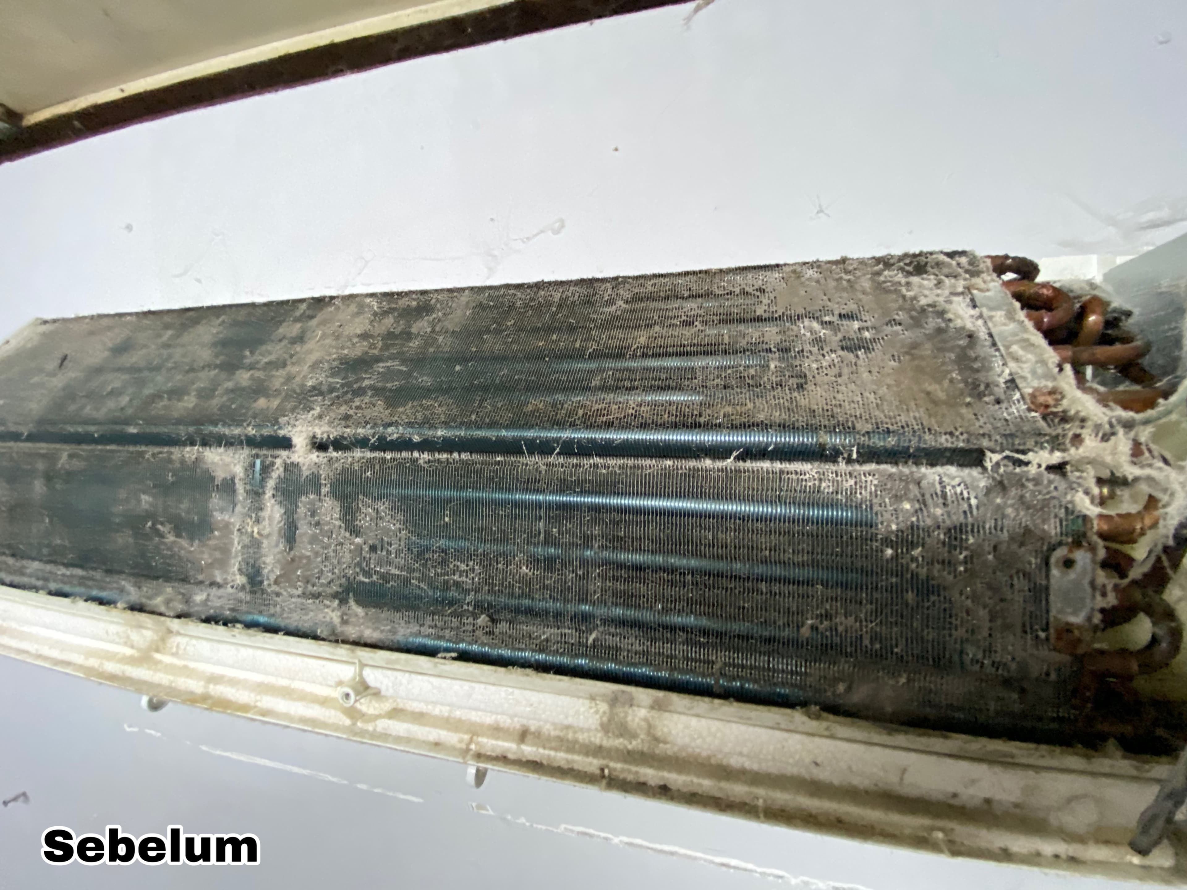Before Internal Blockage Removal